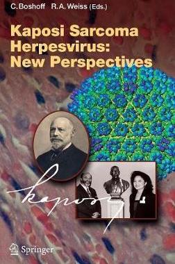 预订 Kaposi Sarcoma Herpesvirus: New Perspectives