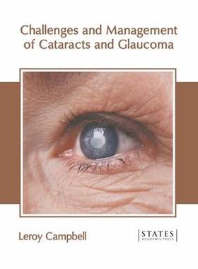 [预订]Challenges and Management of Cataracts and Glaucoma 9781639891016