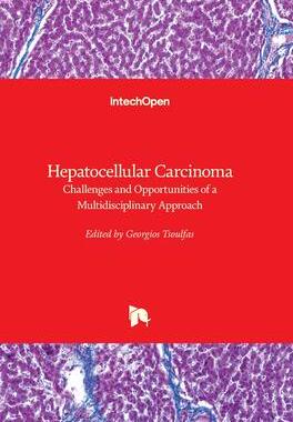 [预订]Hepatocellular Carcinoma - Challenges and Opportunities of a Multidisciplinary Approach 9781839691102