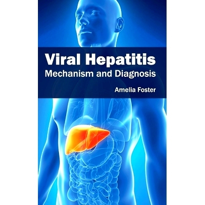 预订 Viral Hepatitis: Mechanism and Diagnosis 病毒性肝炎：机理和诊断: 9781632424235