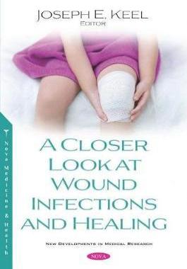 [预订]A Closer Look at Wound Infections and Healing 9781536168167