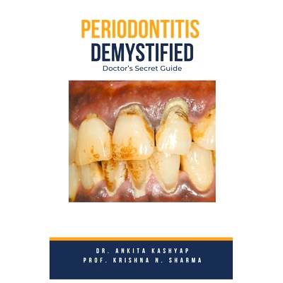 预订 Periodontitis Demystified: Doctor's Secret Guide
