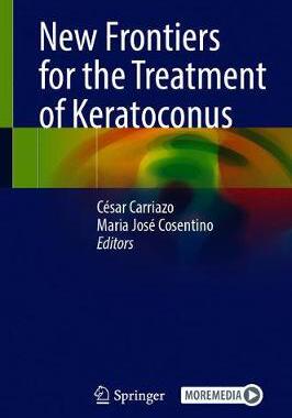 【预订】New Frontiers for the Treatment of Keratoconus