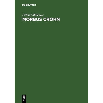 预订 Morbus Crohn: Ein Ratgeber für Patienten und ihre Angehörigen: 9783110124491
