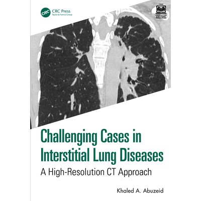 预订 Challenging Cases in Interstitial Lung Diseases A High-Resolution CT Approach 间质性肺疾病的疑难病例:高分辨率CT方