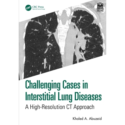 预订 Challenging Cases in Interstitial Lung Diseases A High-Resolution CT Approach 间质性肺疾病的疑难病例：高分辨率CT方