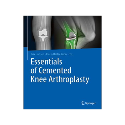 [预订]Essentials of Cemented Knee Arthroplasty 9783662631126