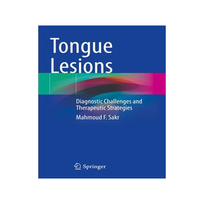 [预订]Tongue Lesions 9783031082009