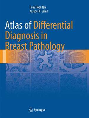 【预订】Atlas of Differential Diagnosis in Breast Pathology