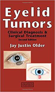 【预售】Eyelid Tumors, Second Edition