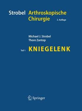 预订 Strobel Arthroskopische Chirurgie