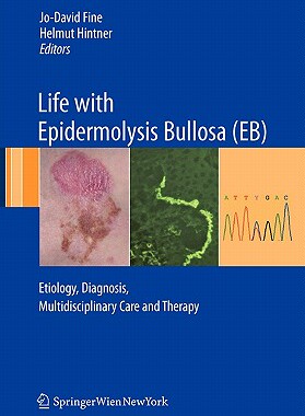 【预订】Life with Epidermolysis Bullosa (EB)