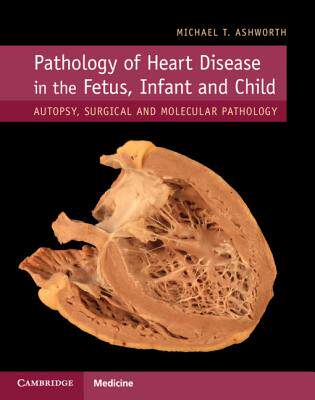 【预订】Pathology of Heart Disease in the Fetus, Infant and Child