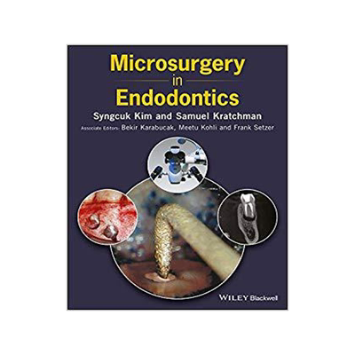 Microsurgery in Endodontics
