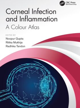 【预订】Corneal Infection and Inflammation: A Colour Atlas 9780367761561