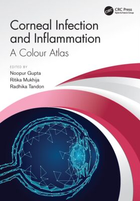 【预订】Corneal Infection and Inflammation: A Colour Atlas 9780367761561