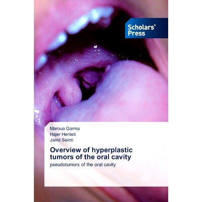 预订 Overview of Hyperplastic Tumors of the Oral Cavity 口腔增生性肿瘤的概述: 9786206774709