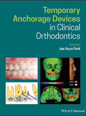 【预订】Temporary Anchorage Devices In Clinical Orthodontics