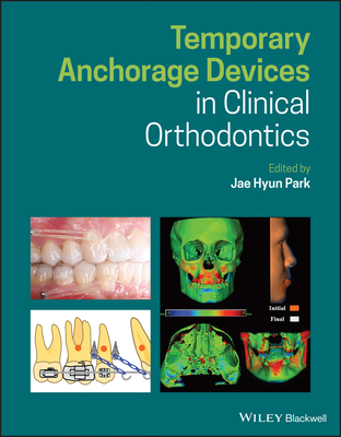 【预订】Temporary Anchorage Devices In Clinical Orthodontics