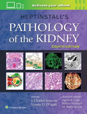 [预订]Heptinstall’s Pathology of the Kidney 9781975161538