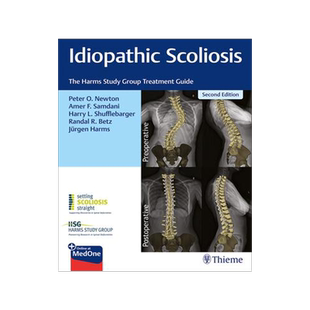 预订 []Idiopathic Scoliosis 9781684200559