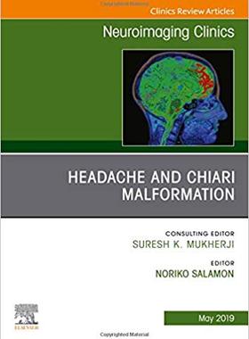 【预售】Headache and Chiari Malformation, An Issue of Neuroimaging Clinics of North America