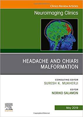 【预售】Headache and Chiari Malformation, An Issue of Neuroimaging Clinics of North America