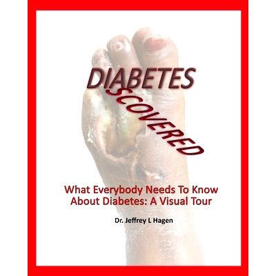 预订 Diabetes Discovered: What Everybody Needs To Know About Diabetes: A Visual Tour