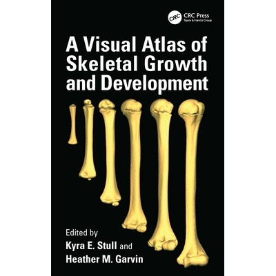 预订 Visual Atlas of Skeletal Growth and Development 骨骼生长发育的视觉图谱 9781032754857