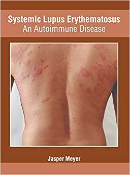 【预售】Systemic Lupus Erythematosus: An Autoimmune Disease