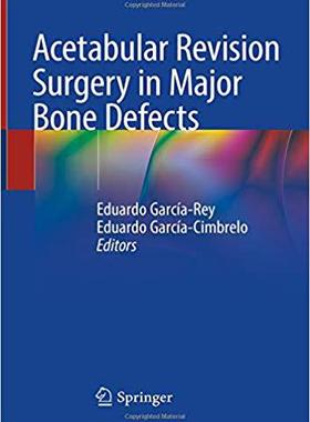 【预售】Acetabular Revision Surgery in Major...