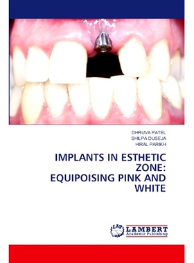 预订 Implants in Esthetic Zone: Equipoising Pink and White: 9786207843923