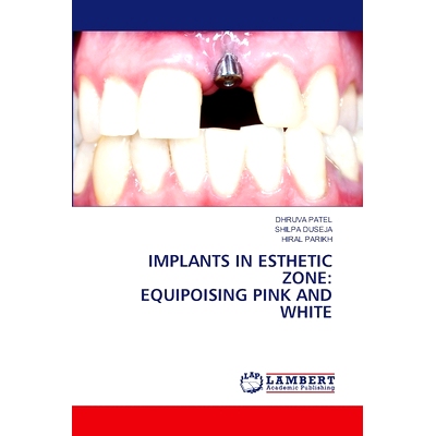 预订 Implants in Esthetic Zone: Equipoising Pink and White: 9786207843923