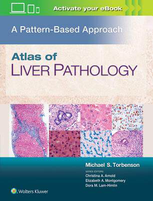 【预订】Atlas of Liver Pathology