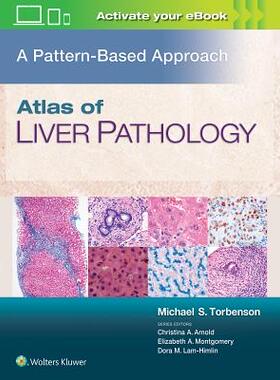 【预订】Atlas of Liver Pathology