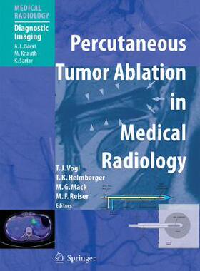 【预订】Percutaneous Tumor Ablation in Medical Radiology