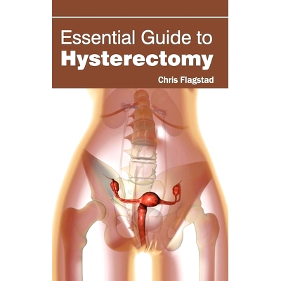预订 Essential Guide to Hysterectomy 子宫切除术基本指南: 9781632421791