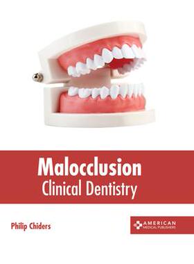[预订]Malocclusion: Clinical Dentistry 9781639270552