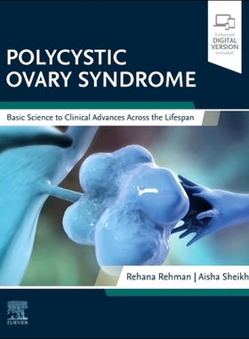 [预订]Polycystic Ovary Syndrome