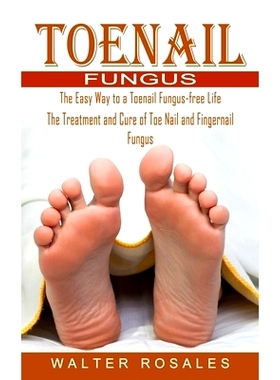 预订 Toenail Fungus: The Easy Way to a Toenail Fungus-free Life (The Treatment and Cure of Toe Nail and Fingernail Fungu