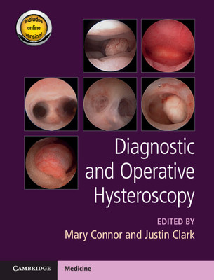 【预订】Diagnostic and Operative Hysteroscopy