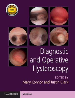 【预订】Diagnostic and Operative Hysteroscopy