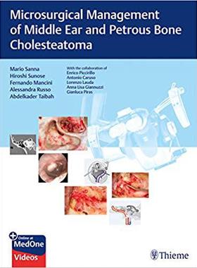 【预售】Microsurgical Management of Middle Ear and Petrous Bone Cholesteatoma