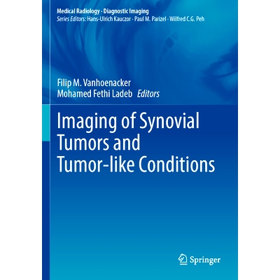 预订 Imaging of Synovial Tumors and Tumor-like Conditions 滑膜肿瘤及肿瘤样病变的影像学研究: 9783031336379