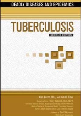[预订]Tuberculosis 9781617530173