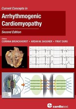 [预订]Current Concepts in Arrhythmogenic Cardiomyopathy, Second Edition 9781942909507