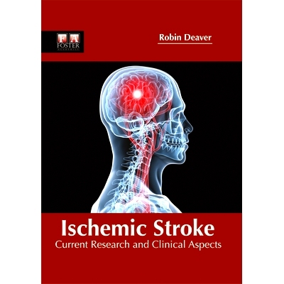 预订 Ischemic Stroke: Current Research and Clinical Aspects 缺血性中风：当前的研究和临床方面: 9781632424952