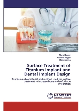 预订 Surface Treatment of Titanium Implant and Dental Implant Design: 9786202556385