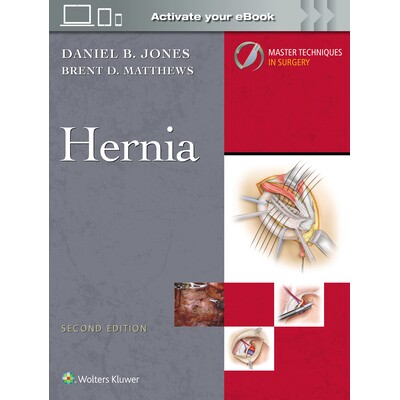 Hernia: Print + eBook with Multimedia (M