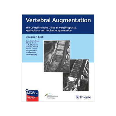 [预订]Vertebral Augmentation 9781684200153